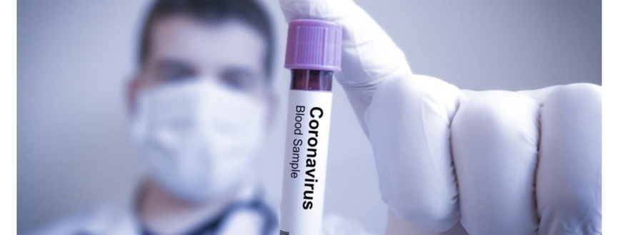 How to predict the future of SARS-CoV-2 pandemic in Poland?